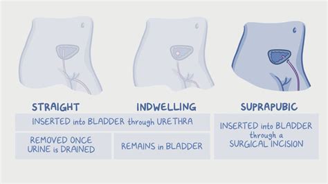 Suprapubic Catheter Female