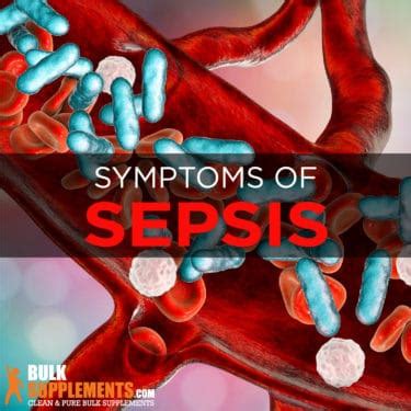 Sepsis: Symptoms, Causes & Treatment