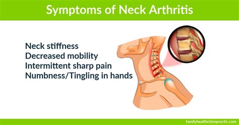 Austin Chiropractor | Can Chiropractic Help Neck Arthritis?