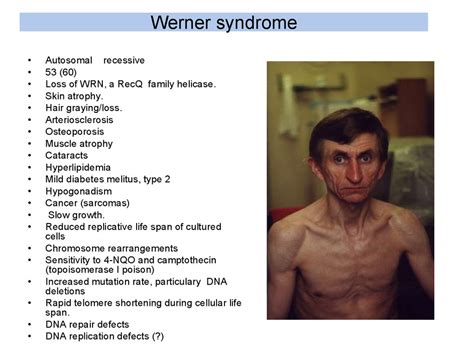 Werner Syndrome