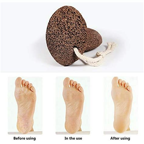 Pumice Stone for feet scrubber - Foot scrubber scrub dead skin removal – Natural Lava pumice ...