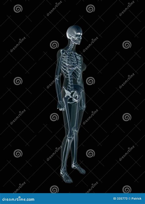 Xray, X-ray of the Human Female Body. Stock Illustration - Illustration ...