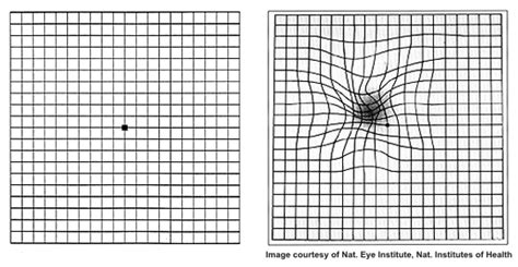 Eye Surgeons of Indiana