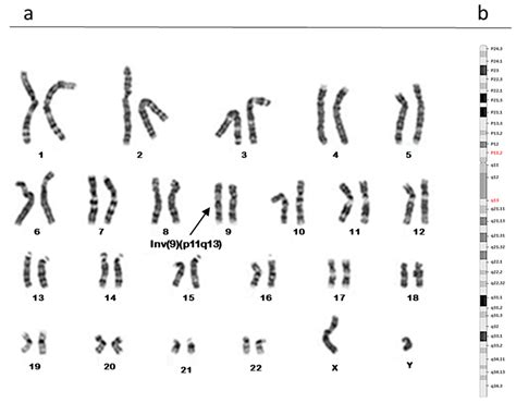 Biomolecules | Free Full-Text | Polymorphic Rearrangements of Human ...