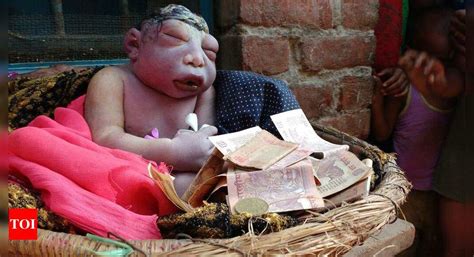 Farrukhabad: Brain dead baby born without skull, worshipped in Farrukhabad district | Agra News ...