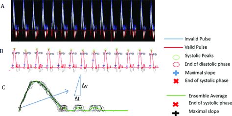 Triphasic Arterial Waveforms