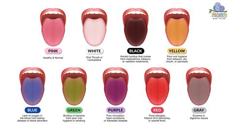 Use This Tongue Color Chart To Understand Your Health