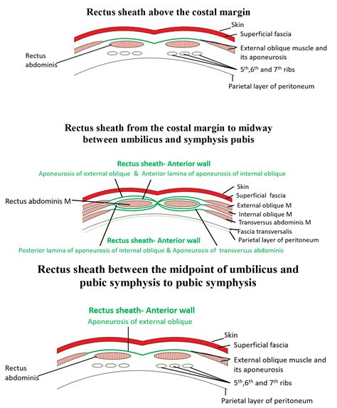 Rectus Sheath , formation, contents, abdominal incisions , Anatomy QA