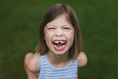 "Joyful Smile Of Girl With Missing Teeth" by Stocksy Contributor "Amanda Worrall" - Stocksy