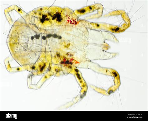 Spider mite (likely Pacific spider mite or Willamette spider mite) under the microscope ...