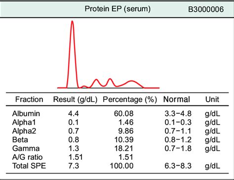 Electrophoresis Serum Protein Test Results