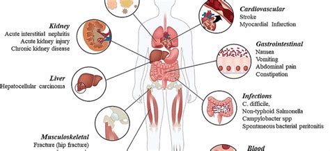 Proton pump inhibitors – drug action, indications, contraindications and side effects – Healthy ...