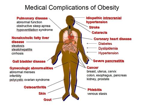 Genetics of Obesity - Diseases Caused by Obesity