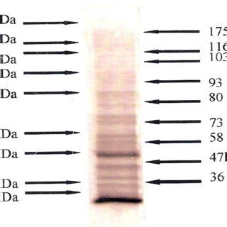 Coomassie blue staining of resolved antigenic bands Thereafter... | Download Scientific Diagram