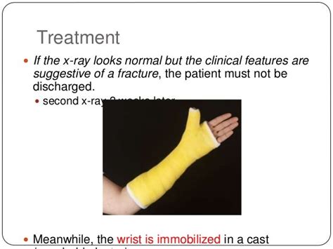 Scaphoid fractures