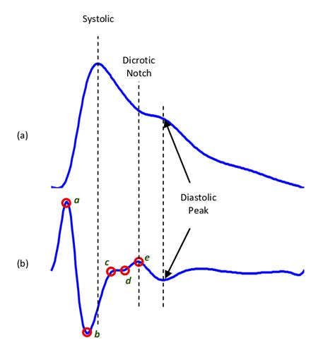 Fingertip photoplethysmogram signal morphology [12]. (a) Fingertip... | Download Scientific Diagram