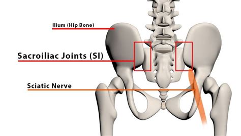 Sciatica problems? Not so fast, it could be your sacroiliac joint