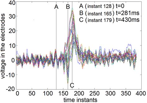 Time series of the Visual Evoked Potential for all electrodes. A:... | Download Scientific Diagram