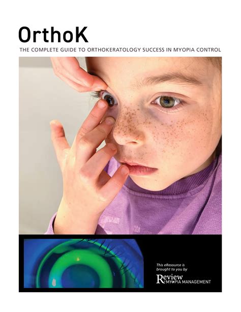 Orthokeratology Contact Lenses Archives - Review of Myopia Management