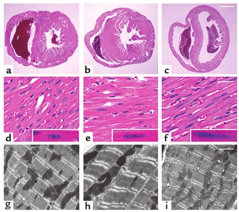 Myocardial histology in mice aged 4-6 weeks. Heart tissue from WT (a,... | Download Scientific ...