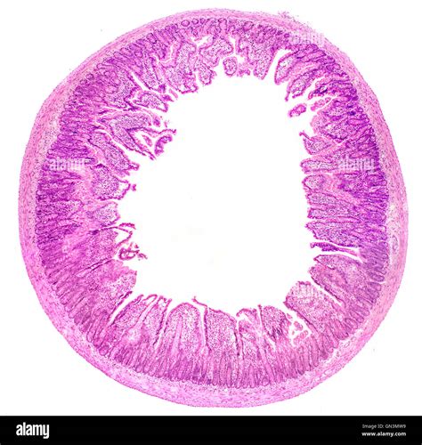 Small intestine villi hi-res stock photography and images - Alamy