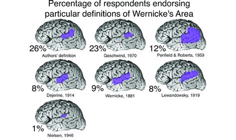 Anatomical definitions of Wernicke's area, and the percentage of ...