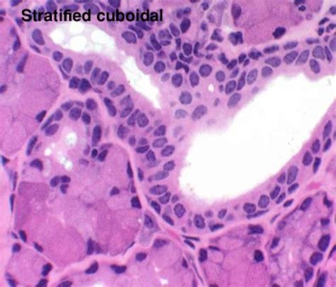 Stratified epithelium