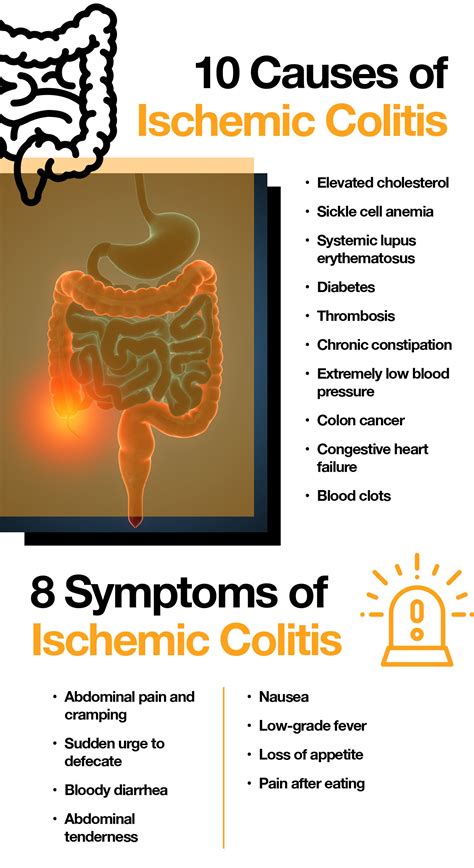 Causes, Signs and Treatment of Ischemic Colitis – The Amino Company