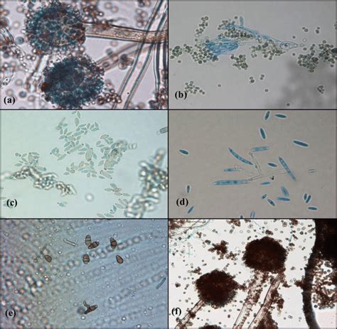 Microscopic image of different fungi observed at optimal magnification... | Download Scientific ...