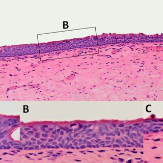 Laryngeal Ventricle Histology