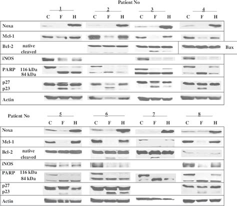 Effects of flavopiridol and hyperforin on the expression of Noxa and... | Download Scientific ...