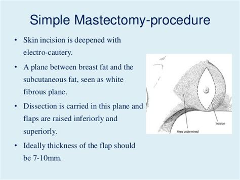 Mastectomy Anatomy