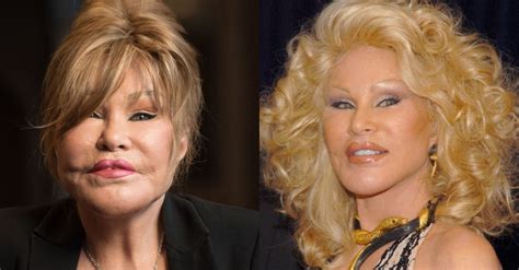 'Catwoman' Jocelyn Wildenstein, 82, Looks Unrecognizable In Snaps