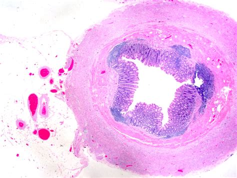 Vermiform Appendix Histology