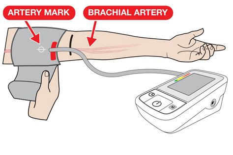 Diabetes Access - Home Blood Pressure Monitoring