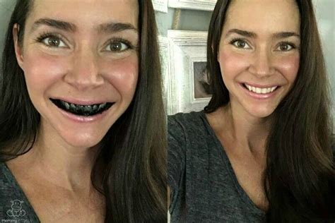 How To Whiten Teeth Naturally With Activated Charcoal | Mommypotamus