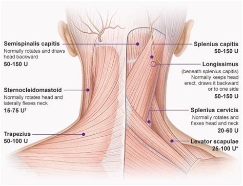 TENSION HEADACHES – Guelph Physiotherapy – Guelph Rehab Centre