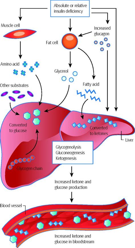 Diabetic ketoacidosis in adults | The BMJ