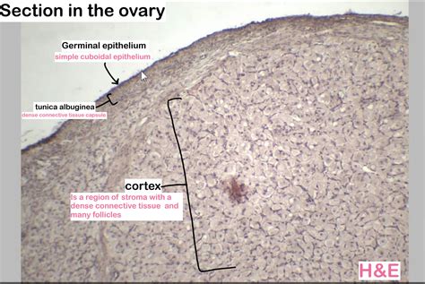 SOLUTION: Histology female reproductive system part 1 - Studypool