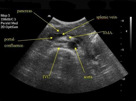 longitudinal view of pancreas. website has abdominal protocol and ...