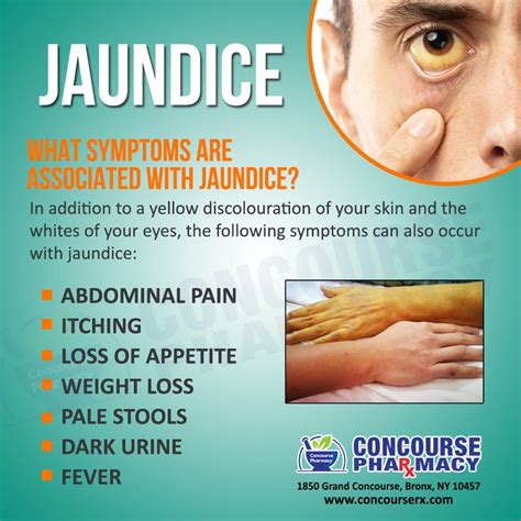 What are the Symptoms of Jaundice | Jaundice symptoms, Pharmacy ...