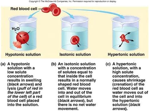 Hypertonic Hypotonic Isotonic Iv Solutions Hypertonic Hypotonic ...