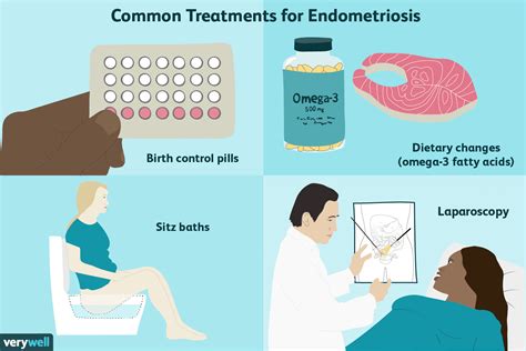 Which Endometriosis Treatment Should You Choose? - Atthefulton