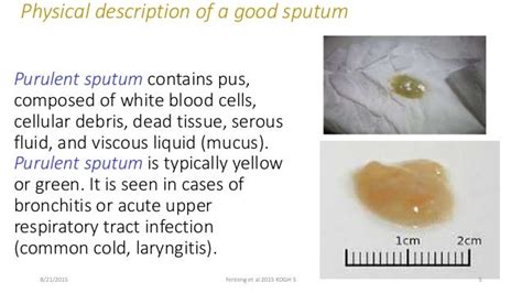 Sputum Examination and Analysis