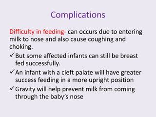 Cleft lip and palate | PPT | Free Download