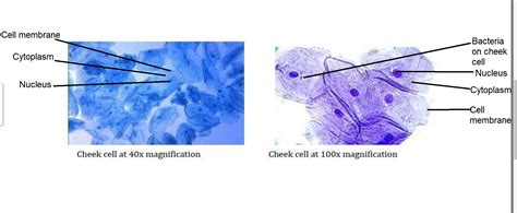 Cheek Cells Under Microscope Labeled