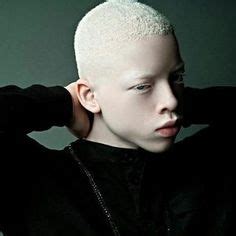 The blackest and whitest men on earth | Dark skin, Albinism, Diversity