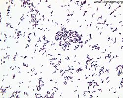 Corynebacterium Diphtheriae Simple Stain