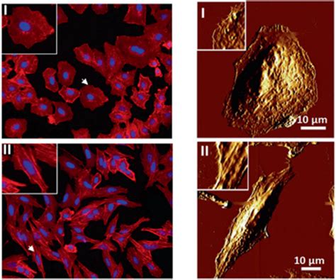 Atomic force microscopy for revealing micro/nanoscale mechanics in tumor metastasis: from single ...
