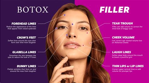 Dermal Fillers vs. Botox: Uses, Difference, and More - Hair Transplant | Looksstudio | Blog